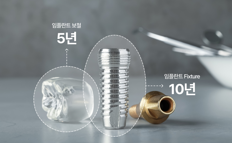 임플란트 10년 보장 제도 이미지